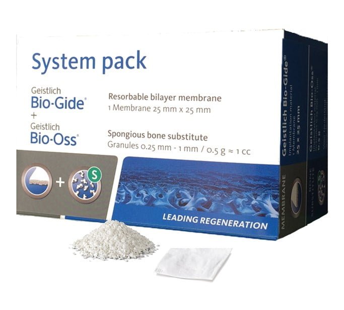 System pack met inhoud